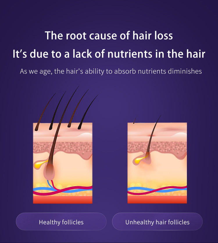Scalp Care Liquid Ultrasonic Atomizing Comb