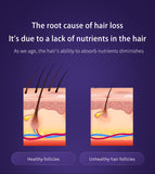 Scalp Care Liquid Ultrasonic Atomizing Comb