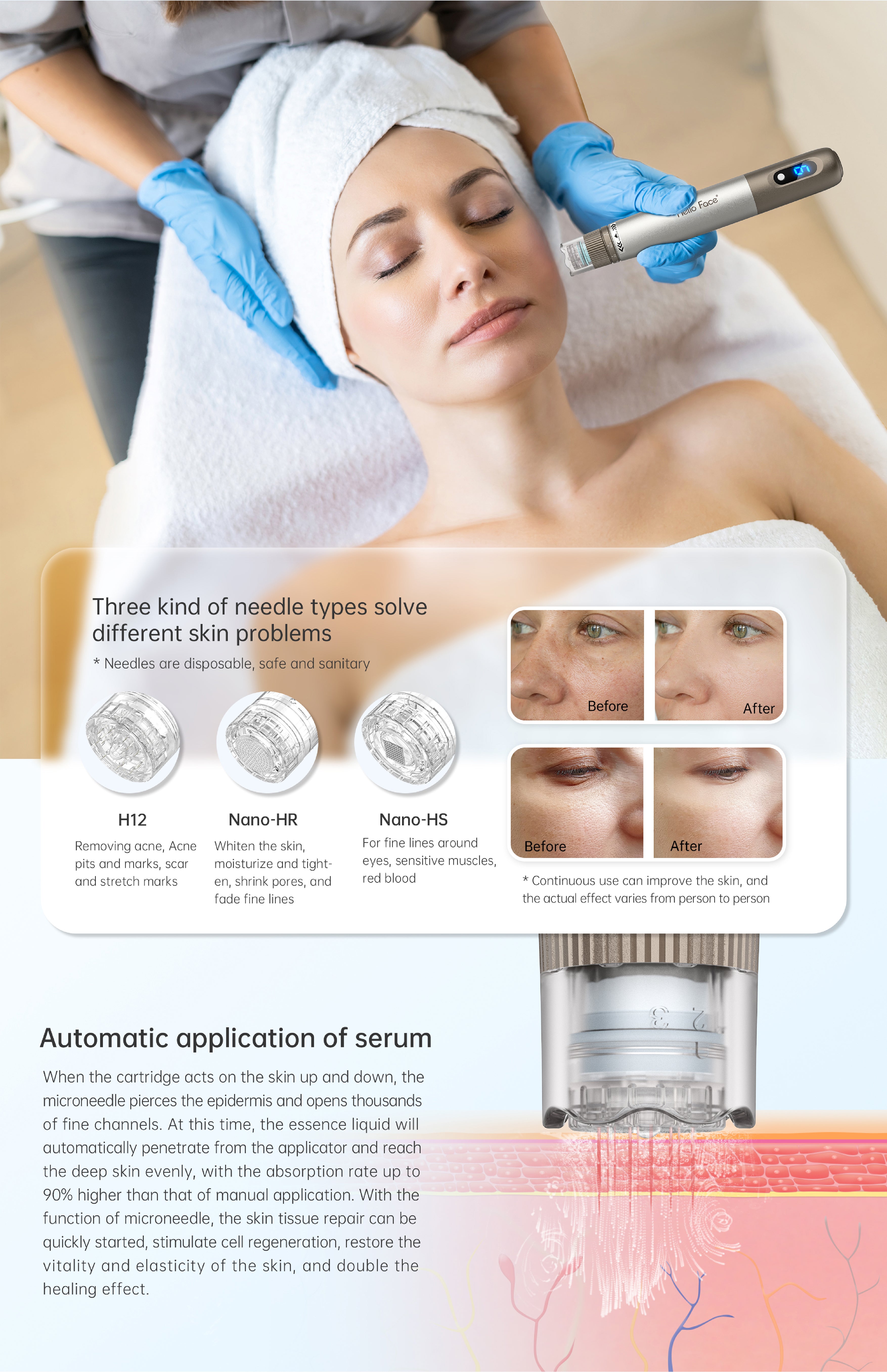 Hello Face New Arrival Injector Hydra Pen H3 for Facial Lifting
