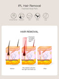 Ipl Portable Latest Professional Skin Rejuvenation Hair Removal Multifunctional Intense Pulsed Light Cooling Machine Treatment