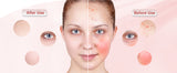 M500S LED Light Therapy Mask